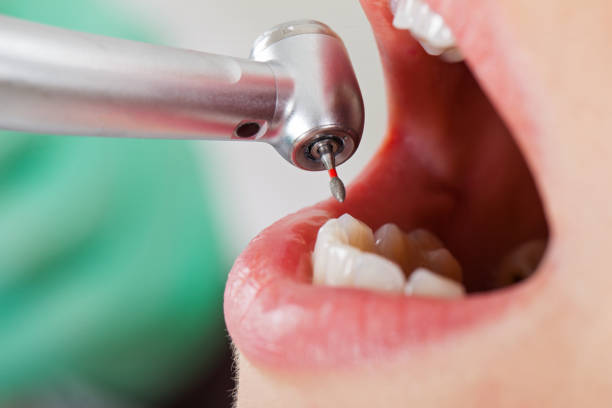 Best Emergency Treatment for Toothache in Fairfield, CA